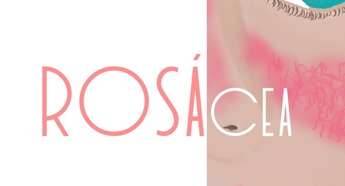 La rosácea en imágenes