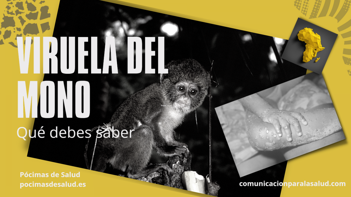 Viruela del mono-mpox