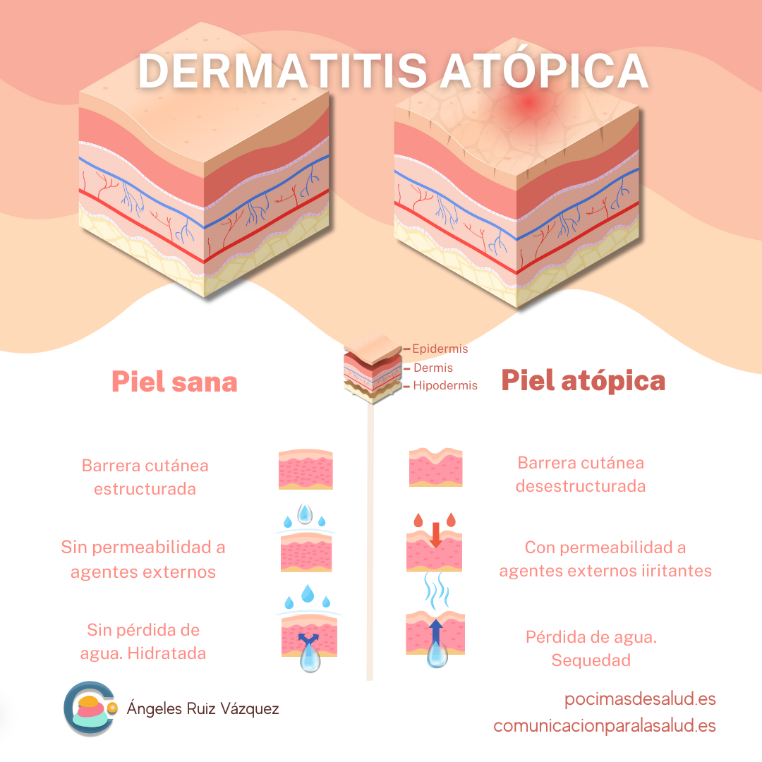 Piel sana vs piel dermatitis
