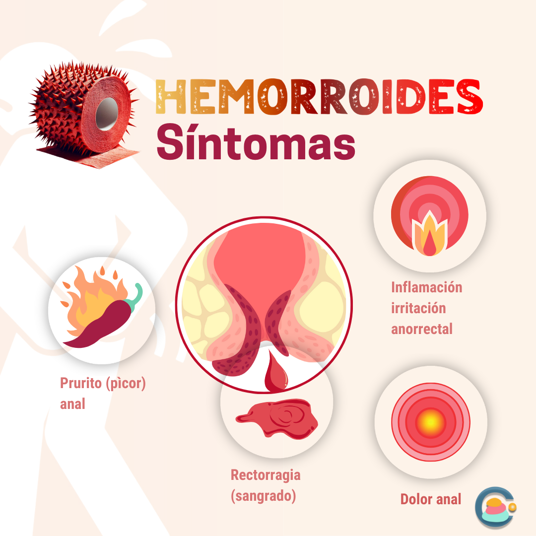 Síntomas de las Hemorroides 